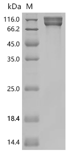 SDS-PAGE