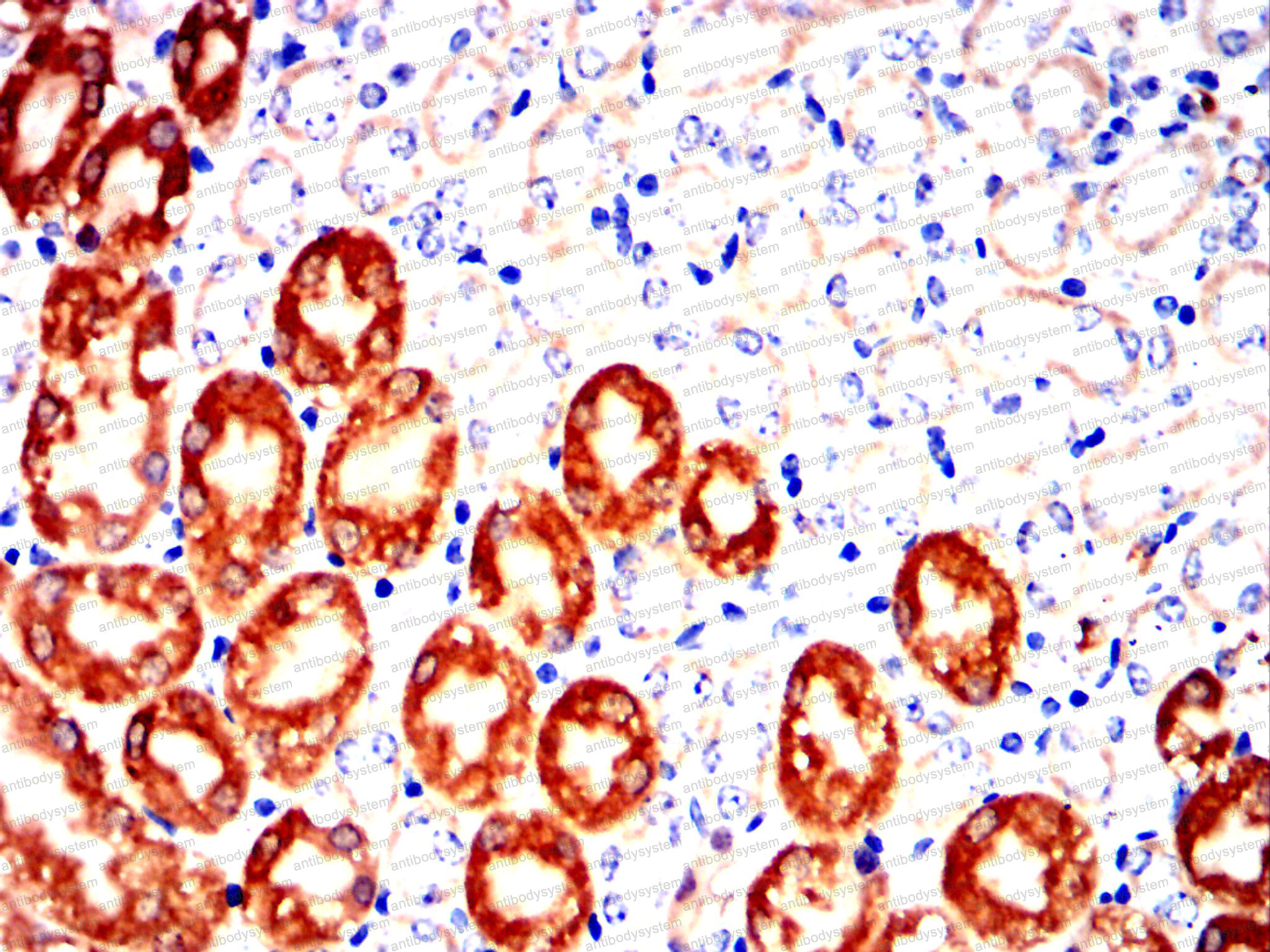 Валидация AntibodySystem RHF42104 (2506)