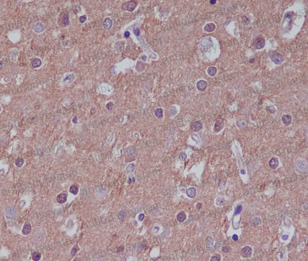 Валидация AntibodySystem RHD39501