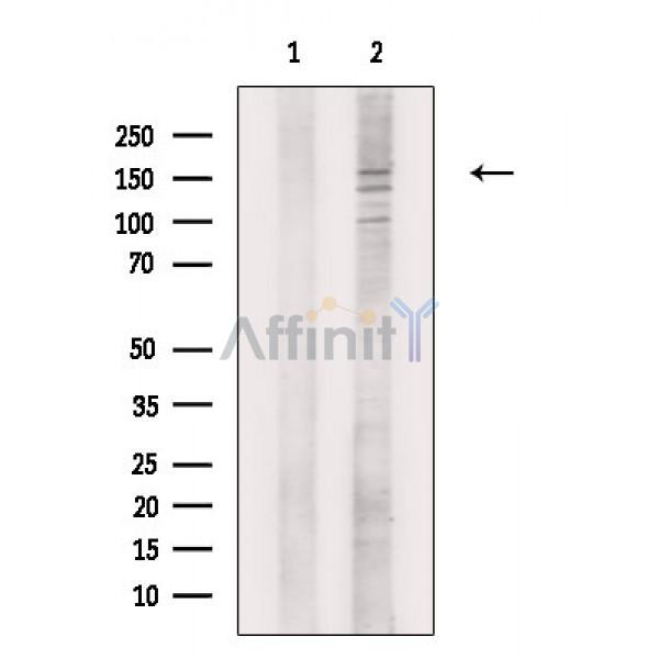 Валидация Affinity DF8814 - 20869