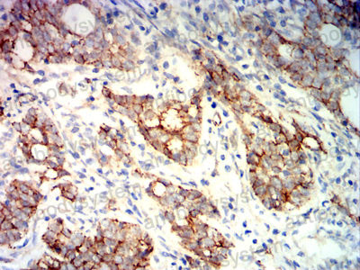 Валидация AntibodySystem RHE07609 (1951)