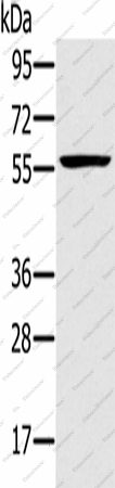 Вестерн-блоттинг, TRIM34, клетки Jurkat