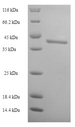 SDS-PAGE