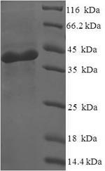 SDS-PAGE
