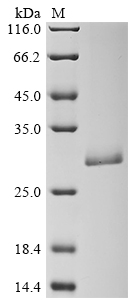 SDS-PAGE