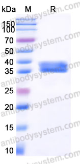EHJ56002, SDS-PAGE