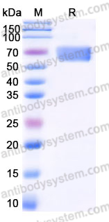 EHJ88501, SDS-PAGE