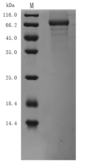 SDS-PAGE