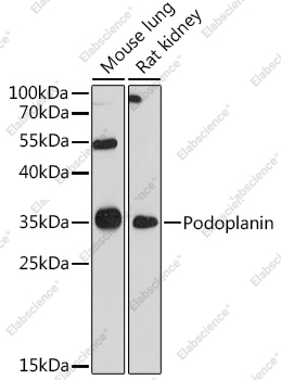 Вестерн-блоттинг, Podoplanin, различные клеточные линии