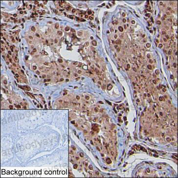 Валидация AntibodySystem RHE53501