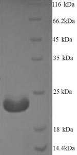 SDS-PAGE