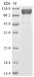 SDS-PAGE