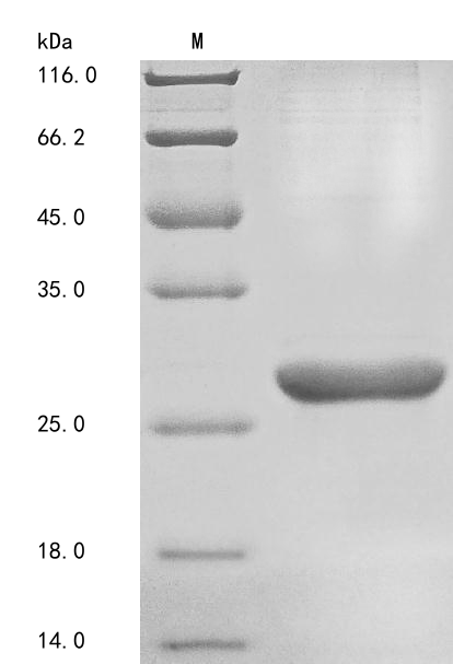 SDS-PAGE