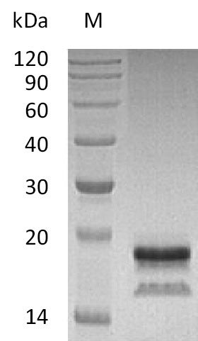 SDS-PAGE