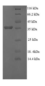 SDS-PAGE