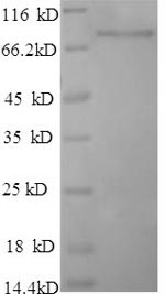 SDS-PAGE