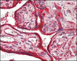 Валидация AntibodySystem RHD75202 (1802)