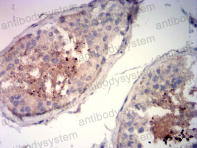 Валидация AntibodySystem RHD70601