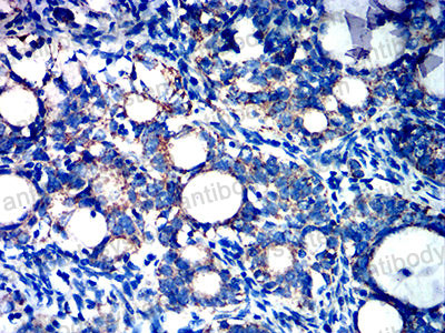 Валидация AntibodySystem RHD65402 (1694)