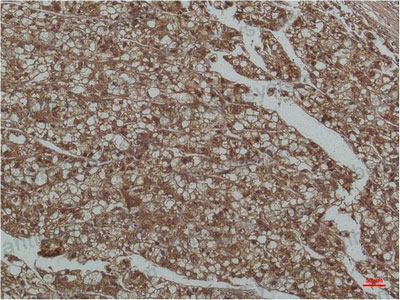 Валидация AntibodySystem RHF75508 (2659)