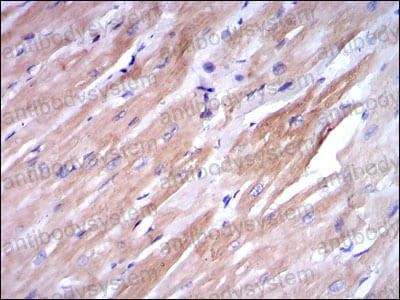 Валидация AntibodySystem RHE61802 (2240)