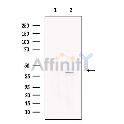 Валидация Affinity DF13704 - 9314