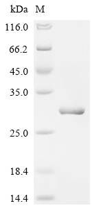 SDS-PAGE
