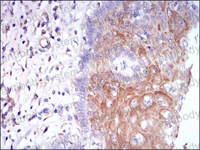 Валидация AntibodySystem RHC25202