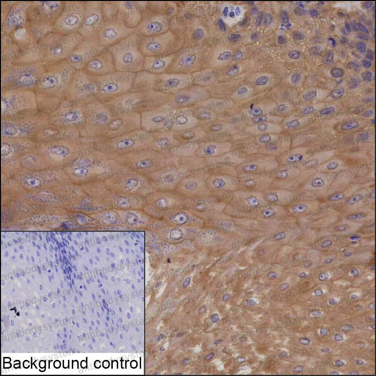 Валидация AntibodySystem RHA62001