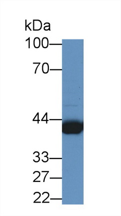 14056