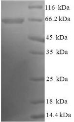 SDS-PAGE