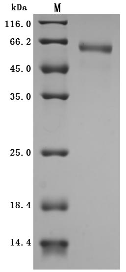 SDS-PAGE