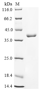 SDS-PAGE