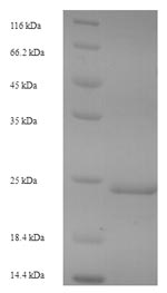 SDS-PAGE