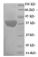 SDS-PAGE