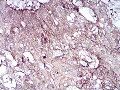 Валидация AntibodySystem RHD87603