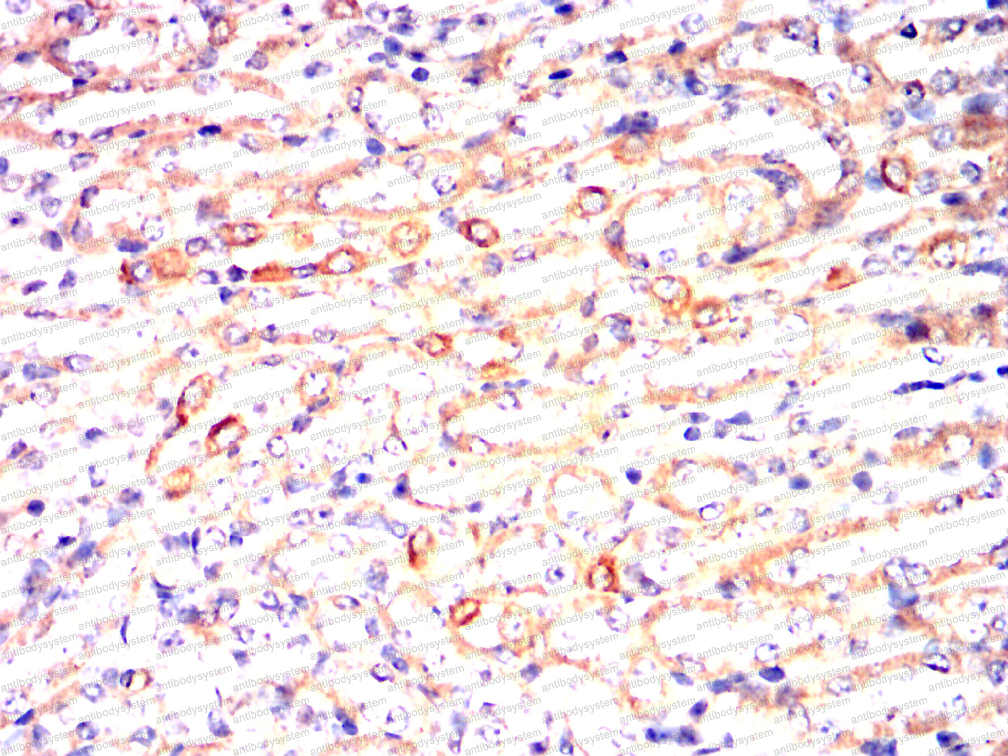 Валидация AntibodySystem RHC87201 (1135)