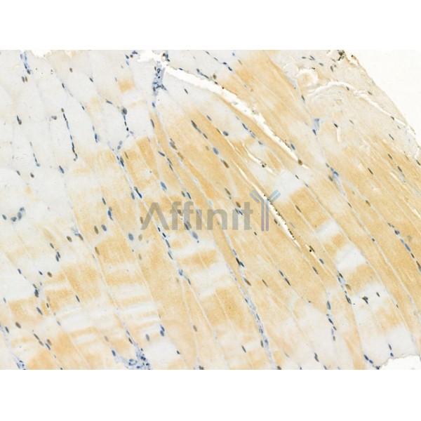 Валидация Affinity DF6426 - 17799