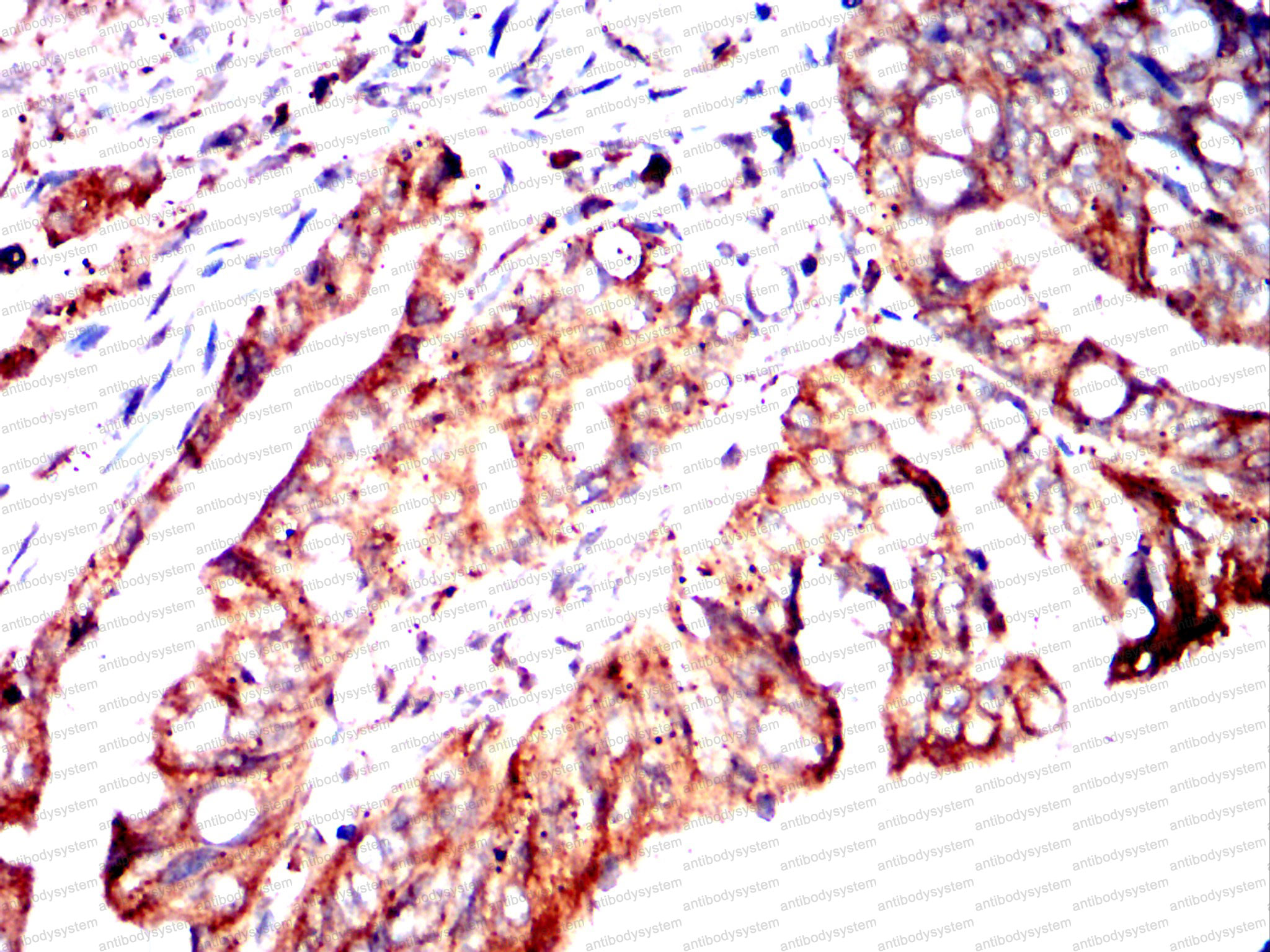 Валидация AntibodySystem RHD38803 (1550)