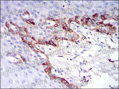Валидация AntibodySystem RHC02401