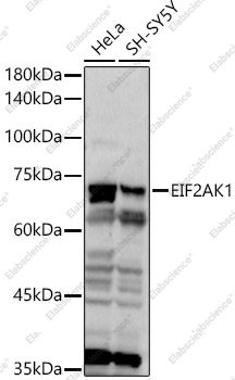 Вестерн-блоттинг, EIF2AK1, различные лизаты