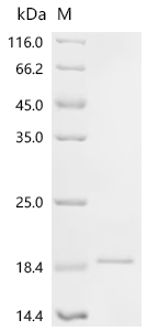 SDS-PAGE