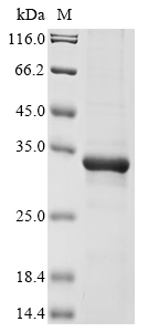 SDS-PAGE