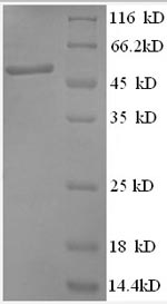 SDS-PAGE