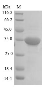SDS-PAGE