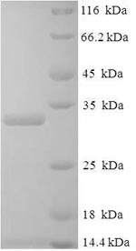 SDS-PAGE