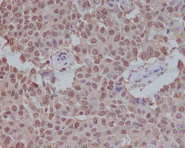 Валидация AntibodySystem RHF59301