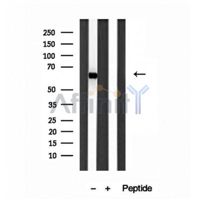 Валидация Affinity DF12003 - 5998