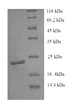 SDS-PAGE