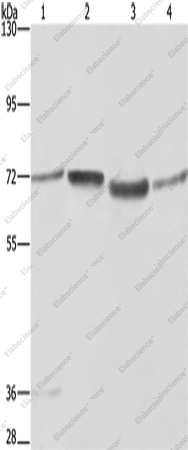 Вестерн-блоттинг, SYN1, клетки A375, 231, 293T и ткань гепатоцеллюлярной карциномы человека